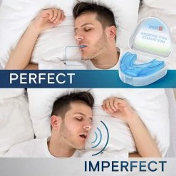 BargainJunkie Dortz Anti Snoring Mouthpiece