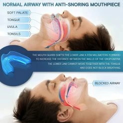 BargainJunkie Dortz Anti Snoring Mouthpiece